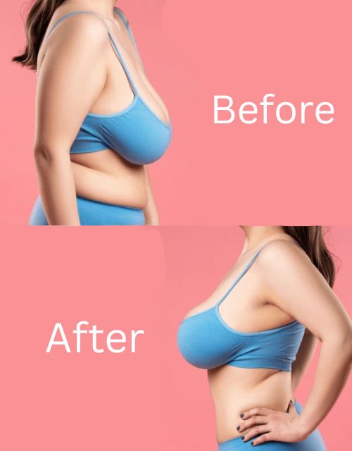 Breast Serum Oil - Breast Oil for Breast Uplift & Tightening, Chest Massage Oil