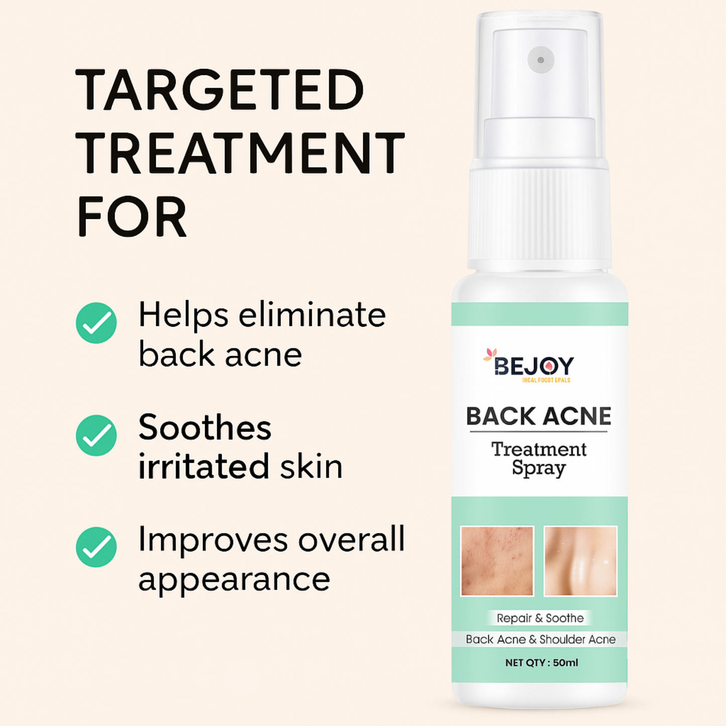 Back and Bum Acne Treatment Spray (Pack of 2)